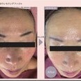 ビフォーアフター