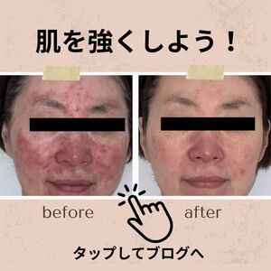 お肌強くするには...