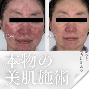 お客様ビフォーアフター☆グランプリ参加者募集中！
