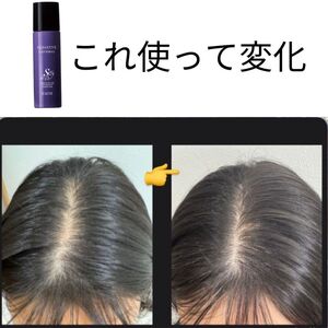 頭皮ケアしよ！キャンペーン開始