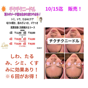 チクチク　　効果はこちら