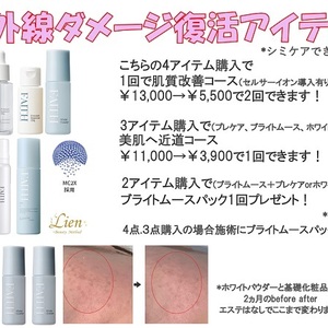 紫外線ダメージ復活アイテム