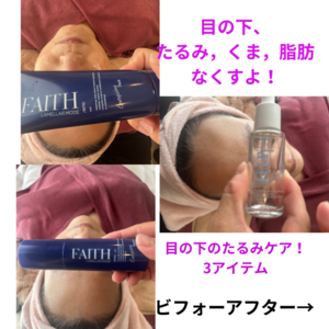 目の下たるみケアのお写真です！