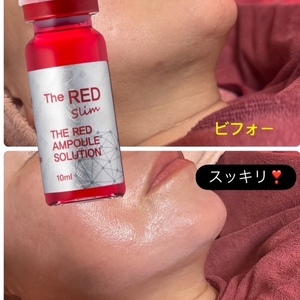 きらない小顔ケアRedshot　お客様ビフォーアフター